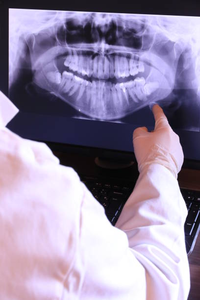 Best Emergency Root Canal Therapy in Durant, MS